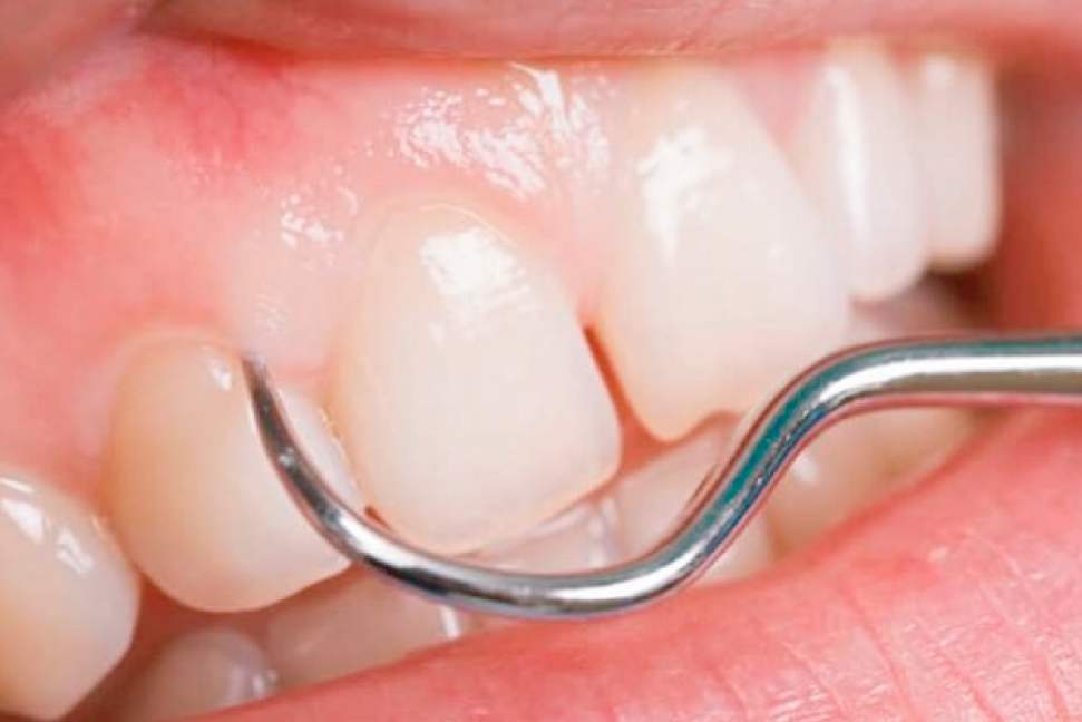 SERVICIO PERIODONCIA